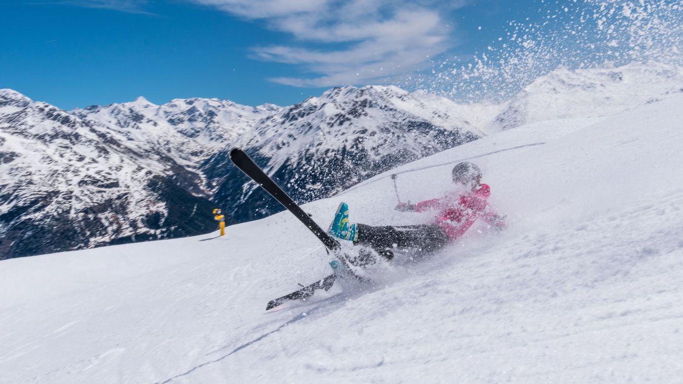 Egy rossz mozdulat, és kész a baj – így reagáljunk lábtörésnél Kép